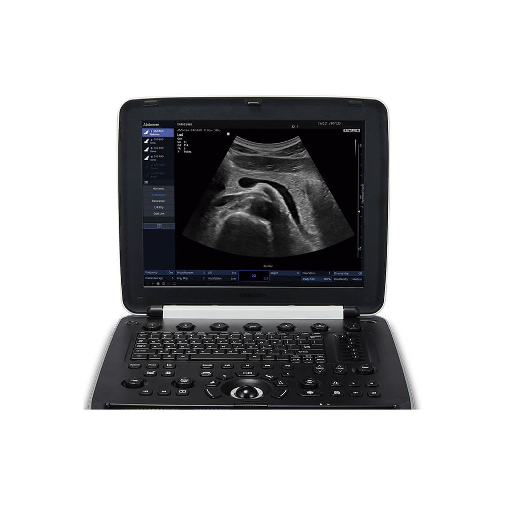 Ecógrafo Samsung HM70 EVO - Imagen 3